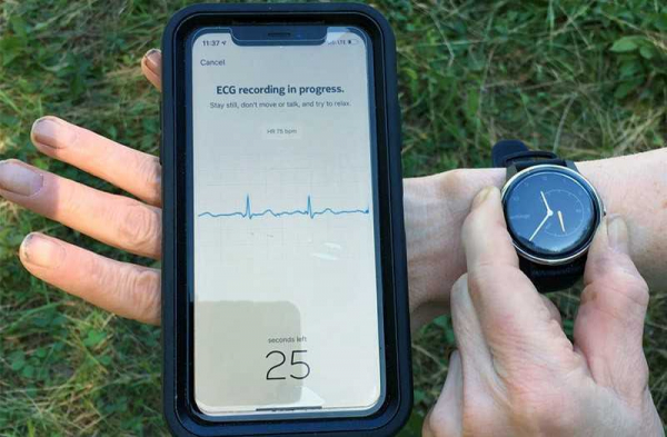 Обзор Withings Move ECG: стильных часов с ЭКГ и фитнес-функциями